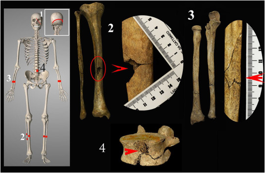 medieval skeleton 2